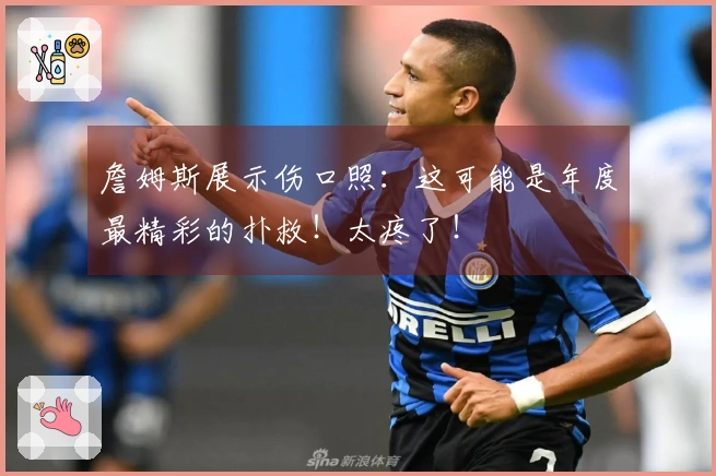 詹姆斯展示伤口照：这可能是年度最精彩的扑救！太疼了！